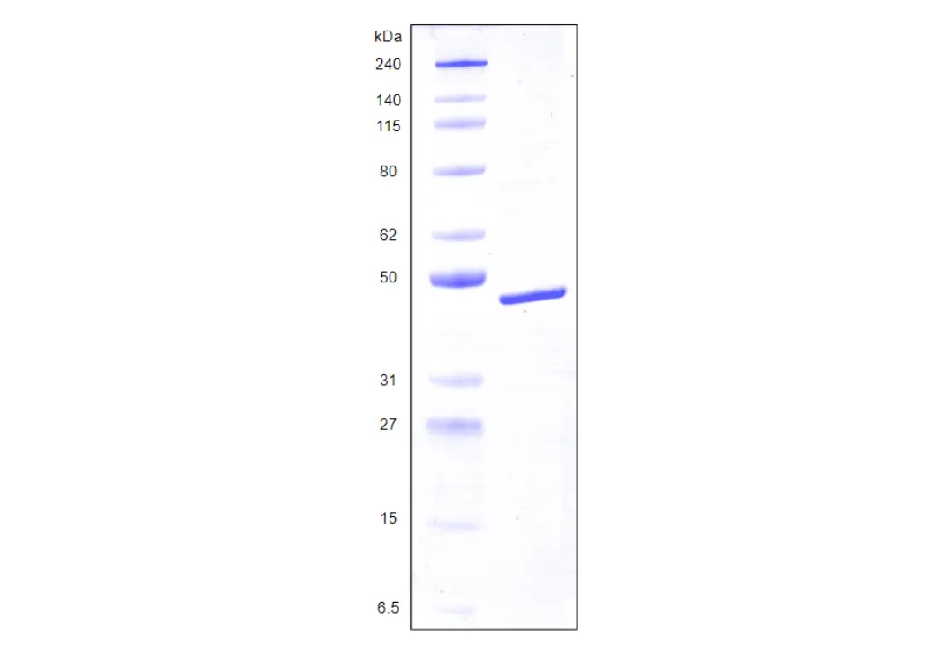 Recombinant Human Galectin 8, variant 2, His Tag (359 a.a.) -50 ug